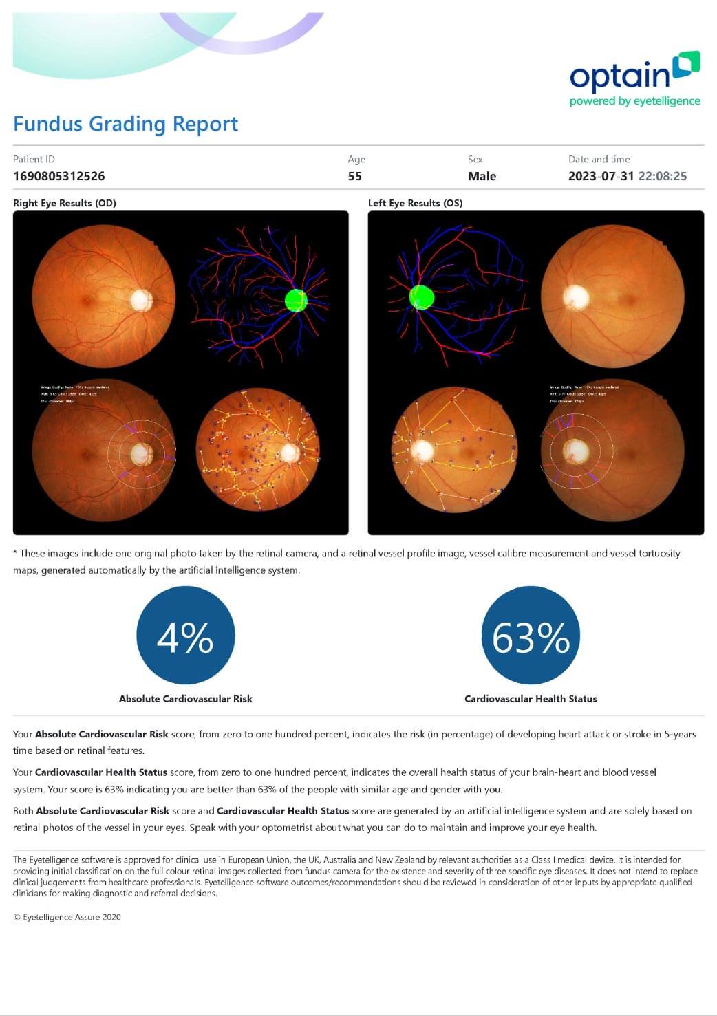 Absolute Cardiovascular Result AI Retinal Imaging