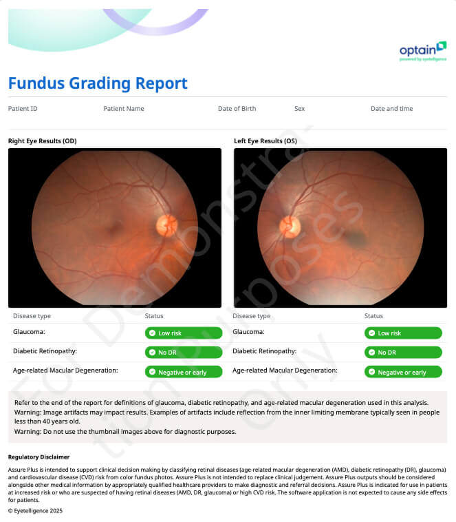 fundusgradingreport fundusgradingreport